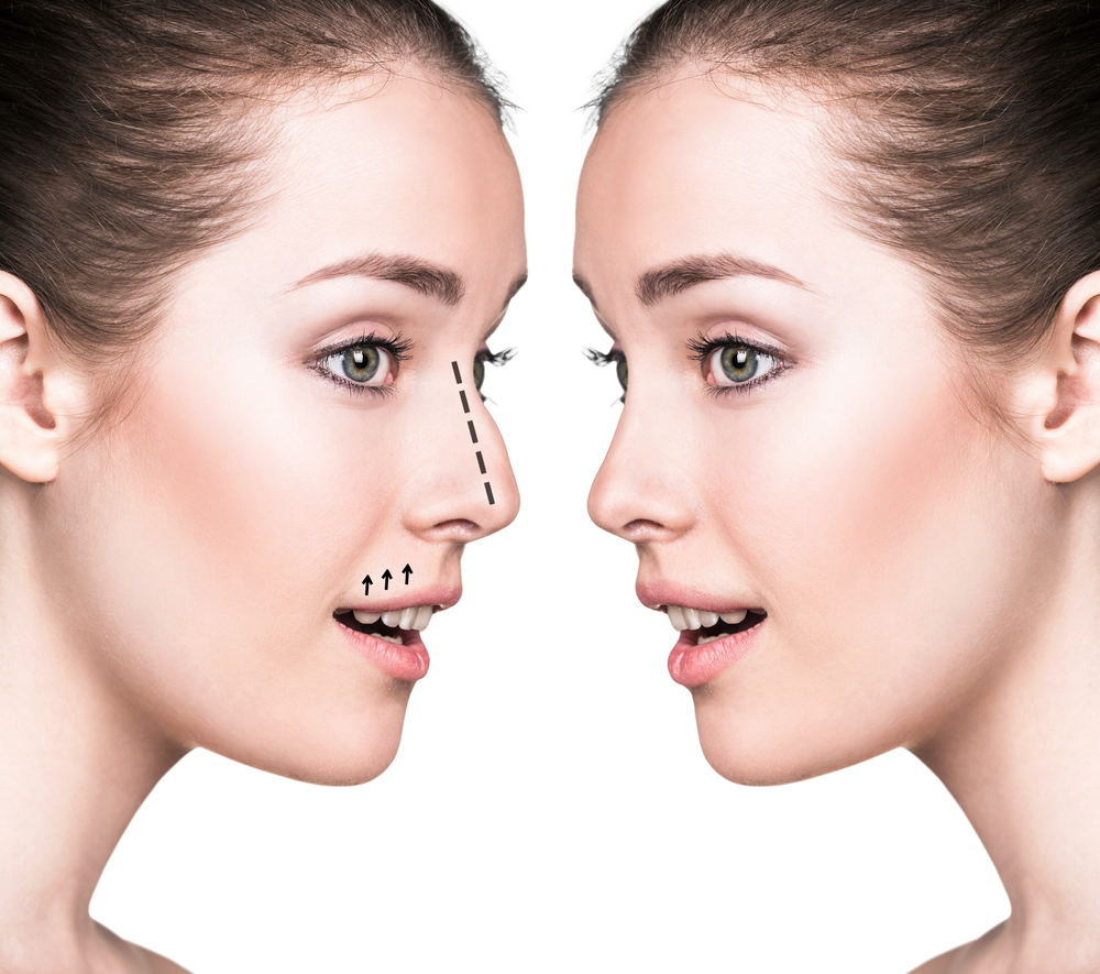 can-a-nose-job-make-nose-smaller-kaniff-cosmetic-medical-center