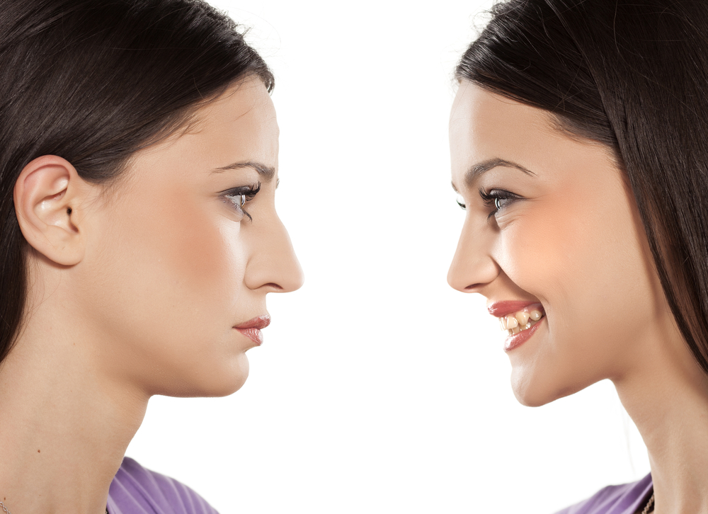 How Long Is Recovery from Rhinoplasty?