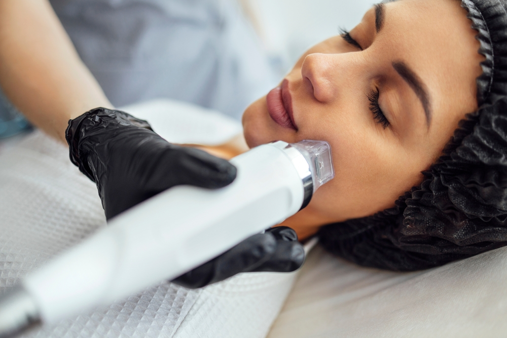 How RF Microneedling Can Turn Back the Clock on Your Skin | Facial Cosmetic Surgery Associates
